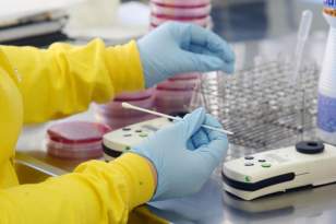 Lacen vai analisar amostras para homologar exames na UEL