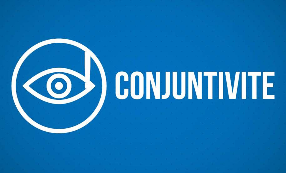 Saúde alerta população sobre os cuidados com conjuntivite Saúde alerta população sobre os cuidados com conjuntivite